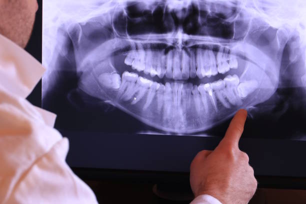 Best Chipped Tooth Repair Near Me  in Baltimore Highlands, MD